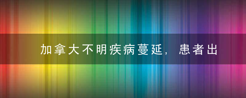 加拿大不明疾病蔓延,患者出现痴呆,幻觉等症状,近日头