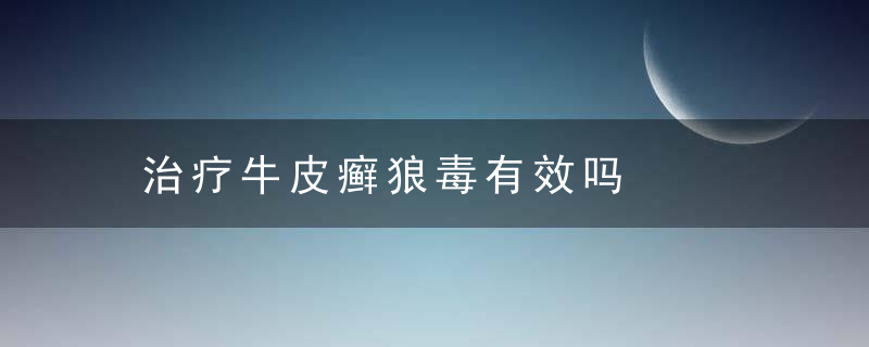 治疗牛皮癣狼毒有效吗，狼毒可以治癣吗