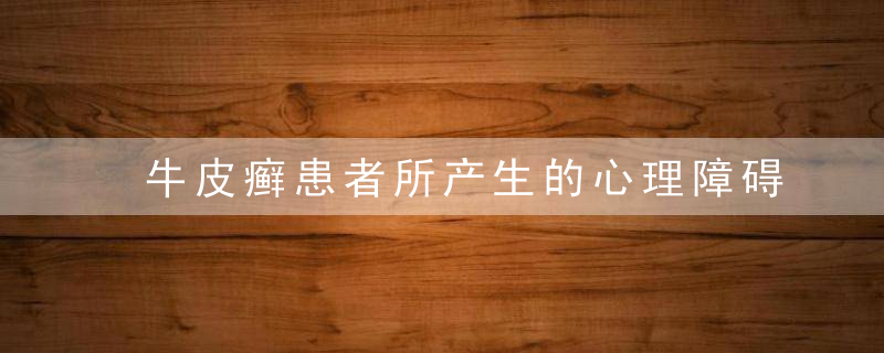 牛皮癣患者所产生的心理障碍有哪些，牛皮肤癣病因